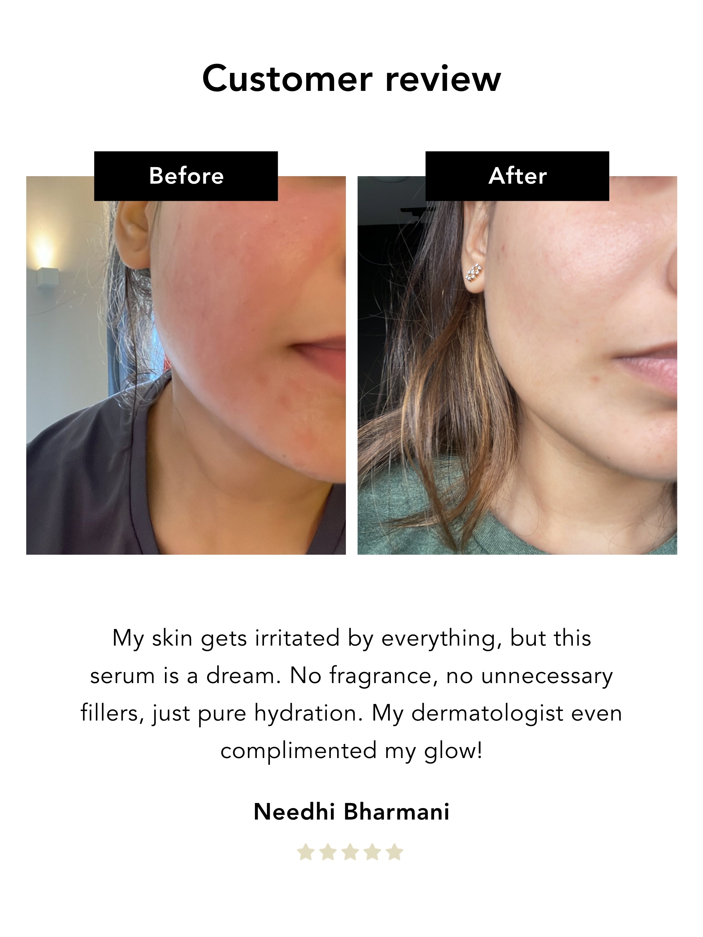 Calm & Care Duo | Noni Peeling Gel & Kudzu Restoring Serum Bundle Nerah Skin