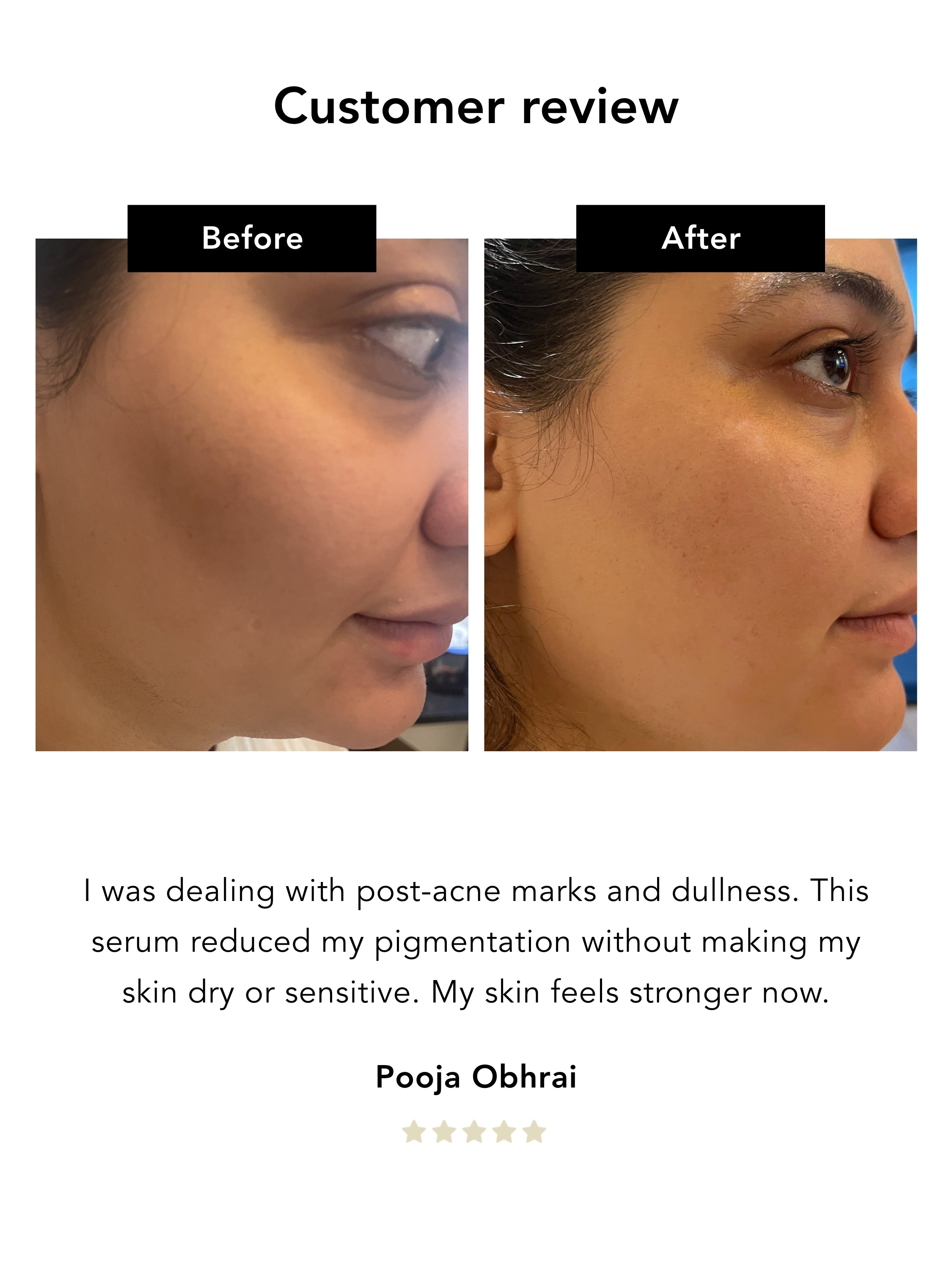 Calm & Care Duo | Noni Peeling Gel & Kudzu Restoring Serum Bundle Nerah Skin